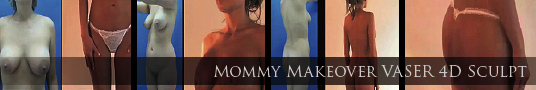 Mommy Makeover VASER® 4D Sculpt™